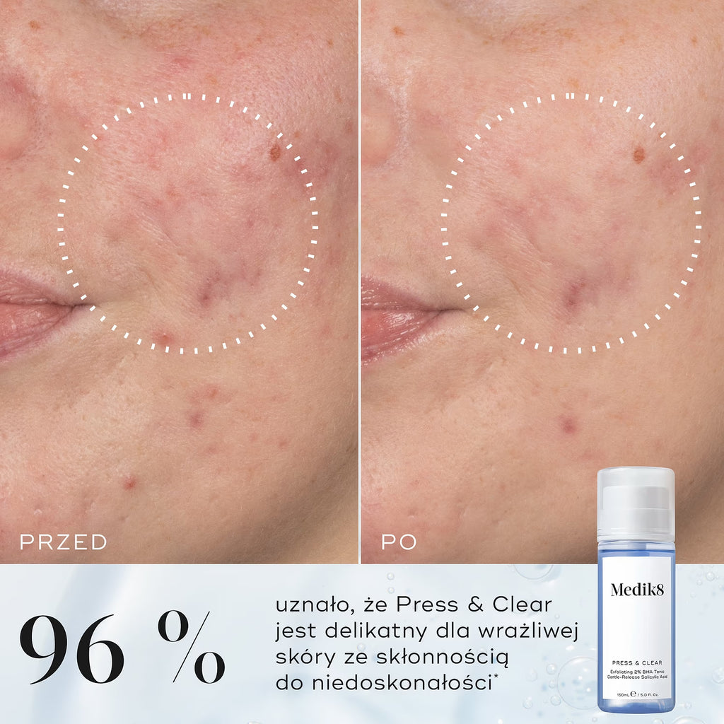 Medik8 Press & Clear Pore-Refining 2% BHA Tonic 150 ml