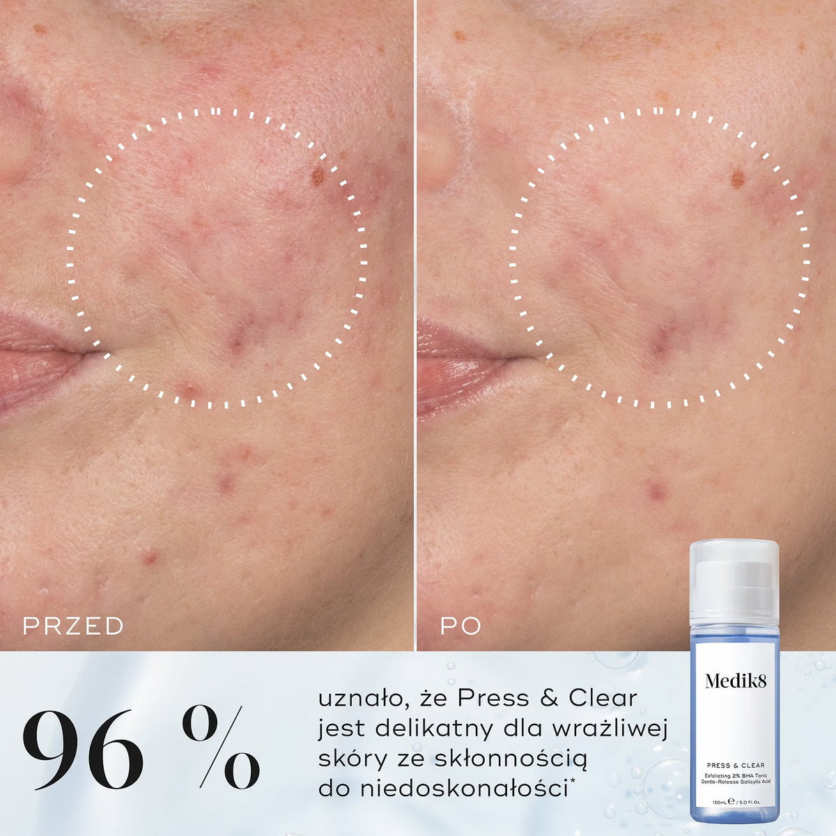 Medik8 Press & Clear Pore-Refining 2% BHA Tonic 150 ml